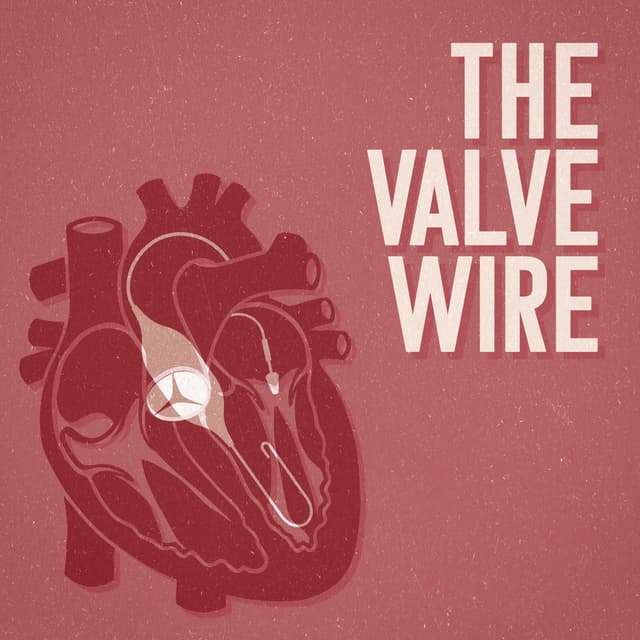 The Valve Wire Weekly Podcast